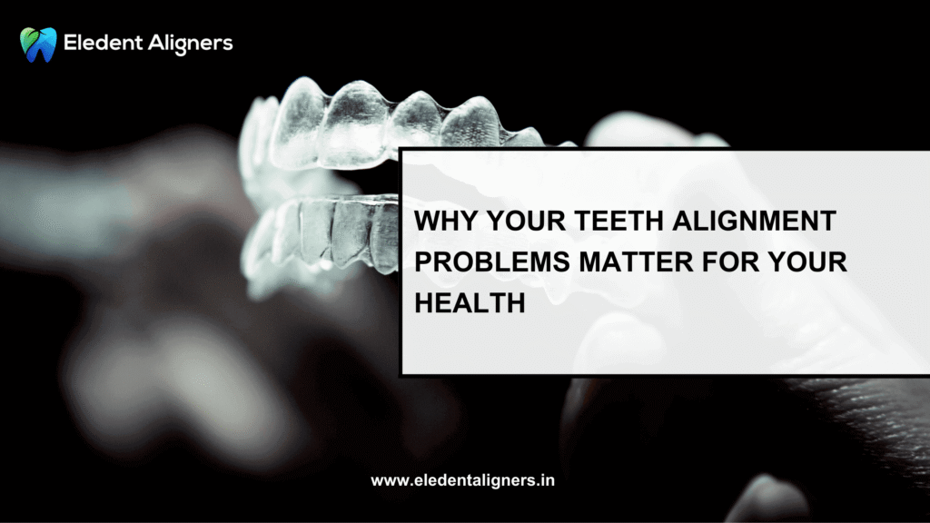 teeth alignment problems