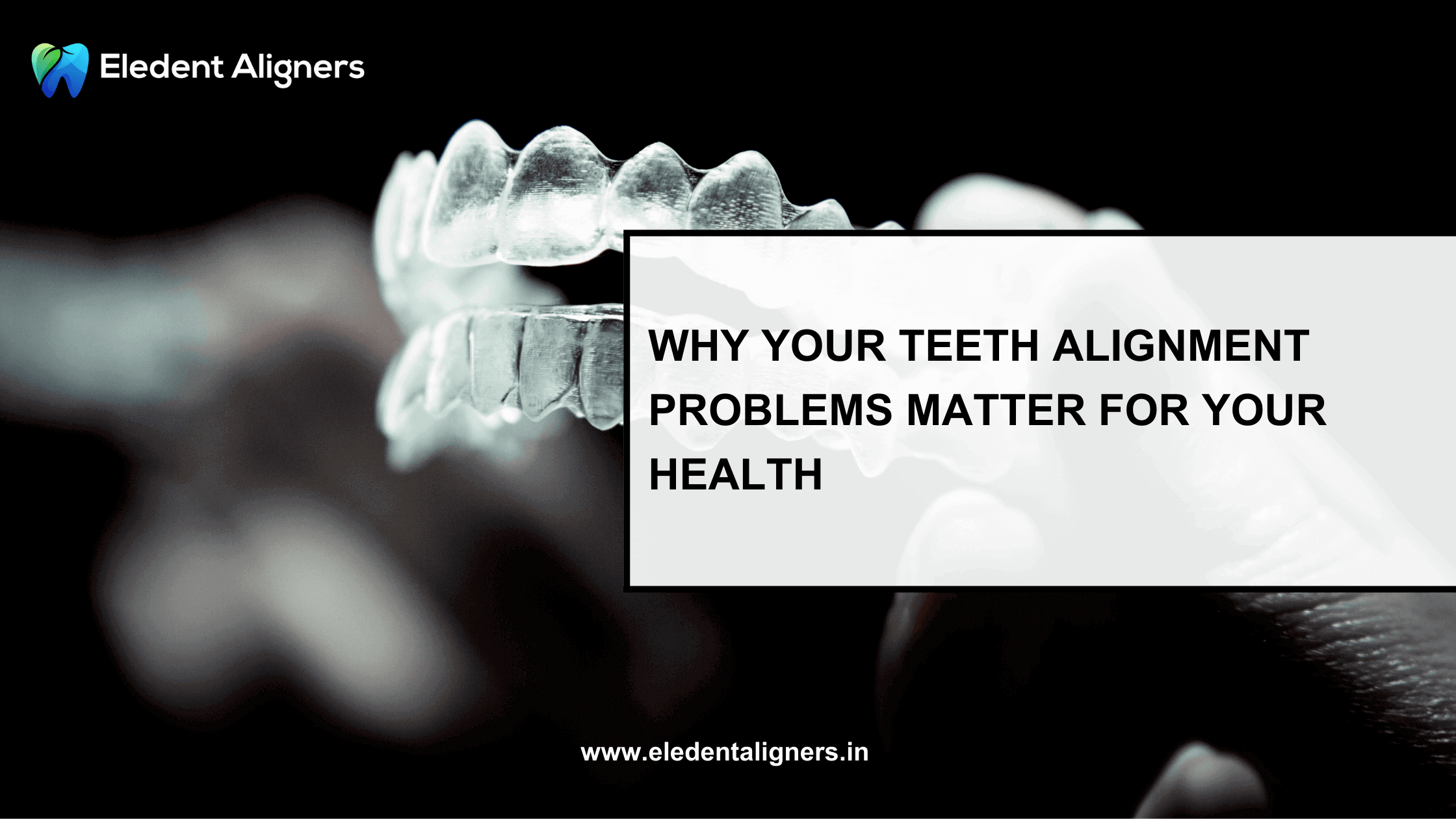 teeth alignment problems