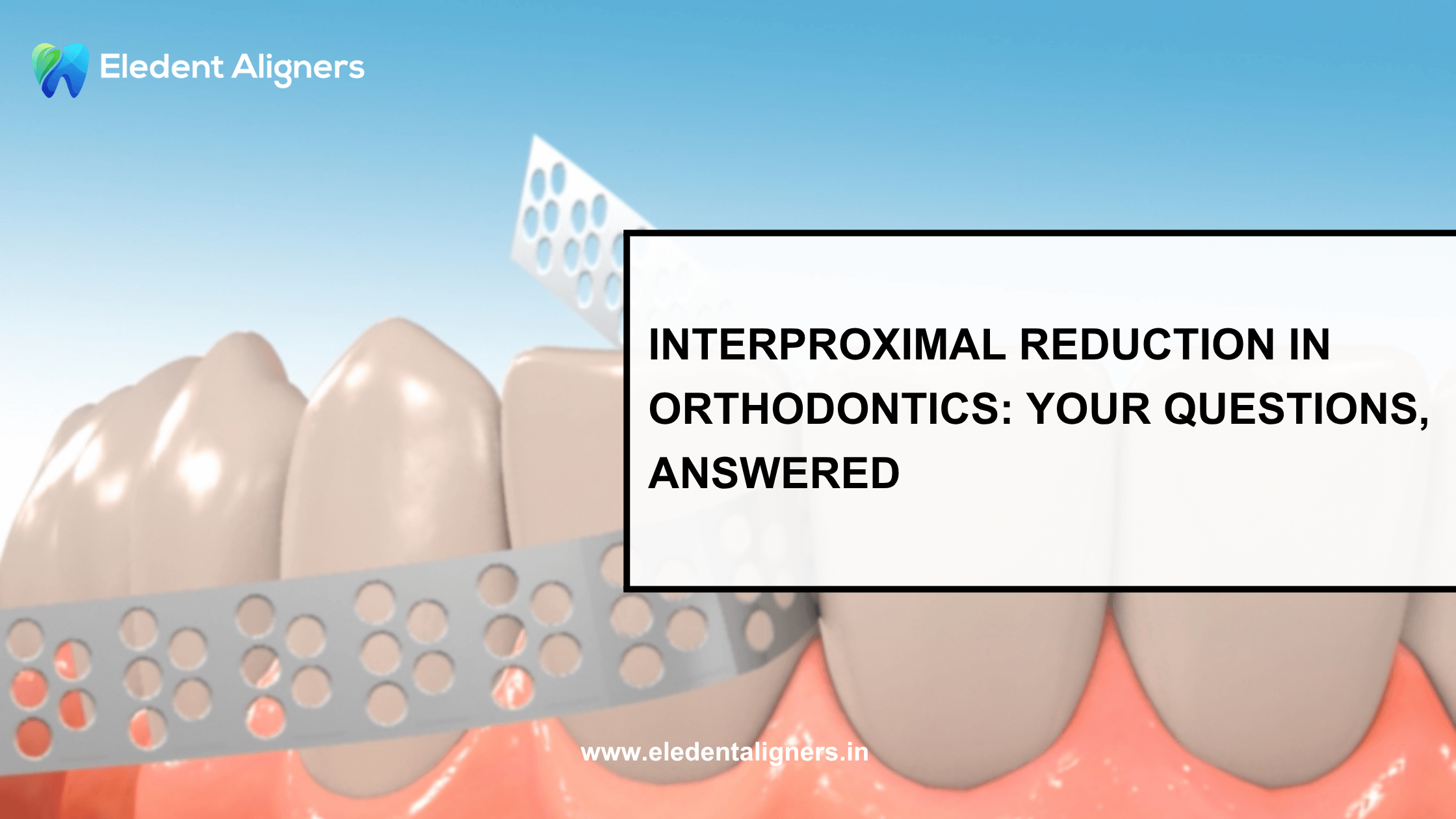 Interproximal Reduction in Orthodontics