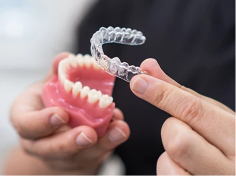 Clear aligner tray designed for comfortable teeth alignment