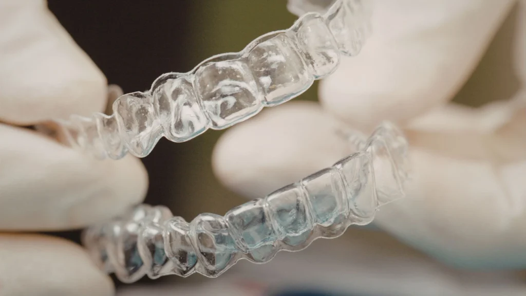 What is Refinement Planning in Aligners?