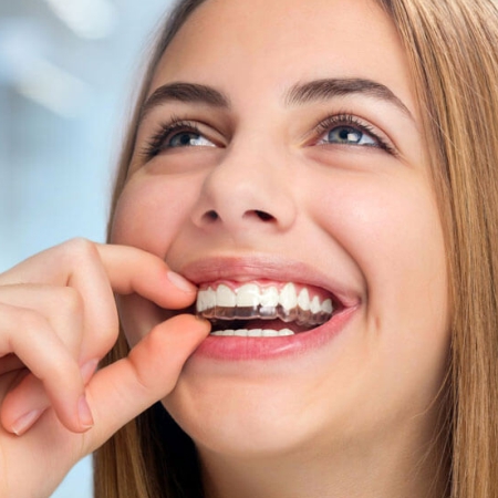 Patient inserting clear aligners for smile correction